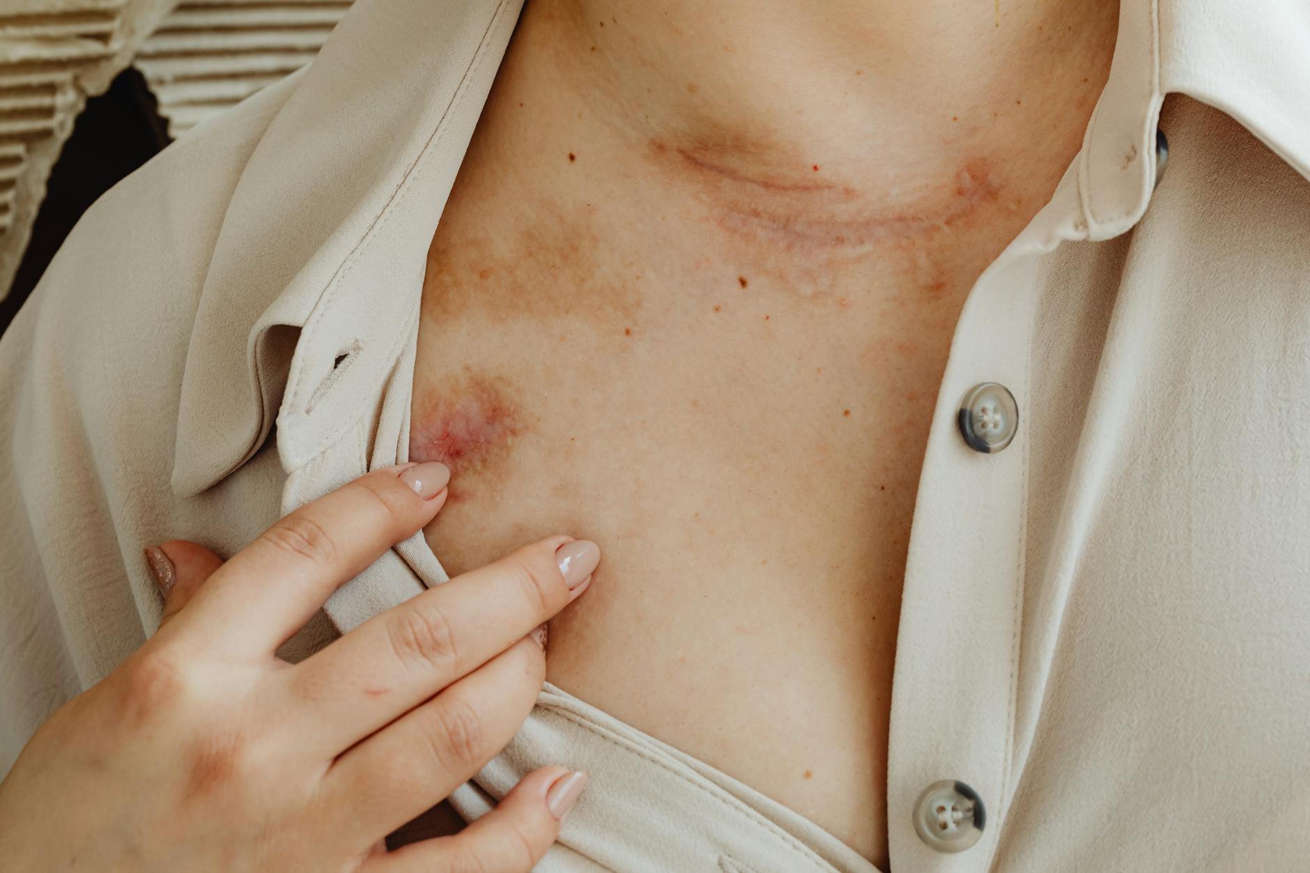 When Does Your Skin Condition Cross the Line Into Medical Territory?